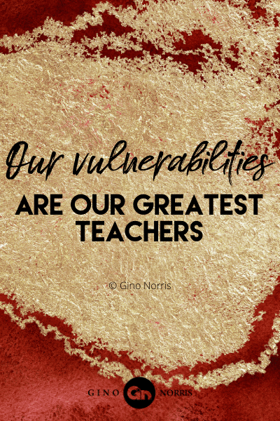 277WQ. Our vulnerabilities are our greatest teachers